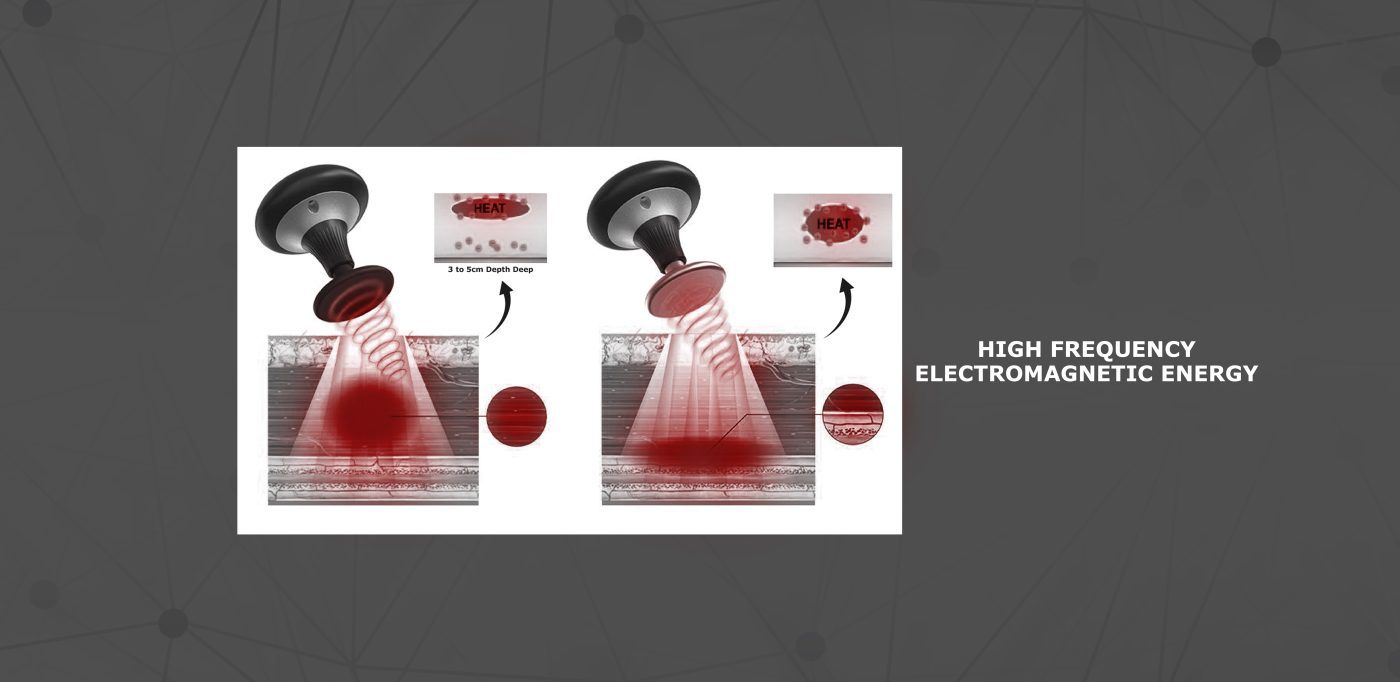 IndiMotion, treatment scene 3