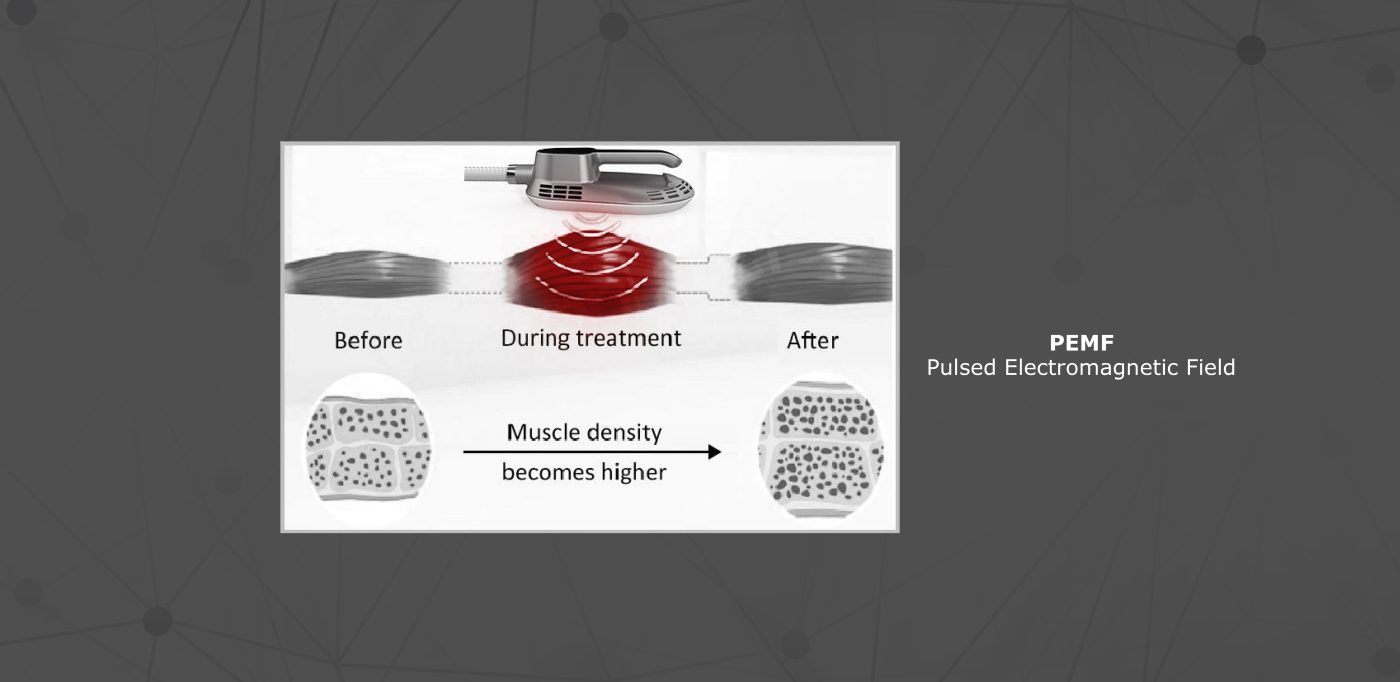 InShape, treatment scene 3